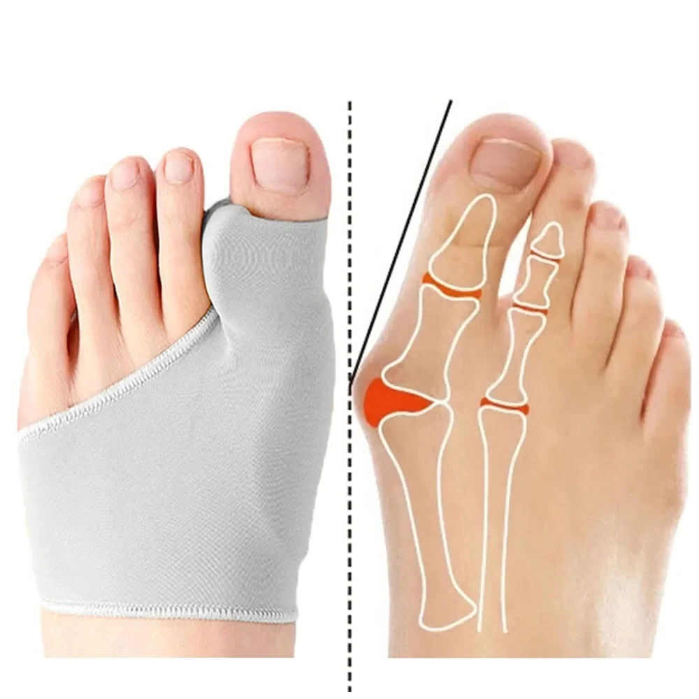 1/2Pair Toe Separator Hallux V - Ankle Brace Sock 리뷰 및 가격