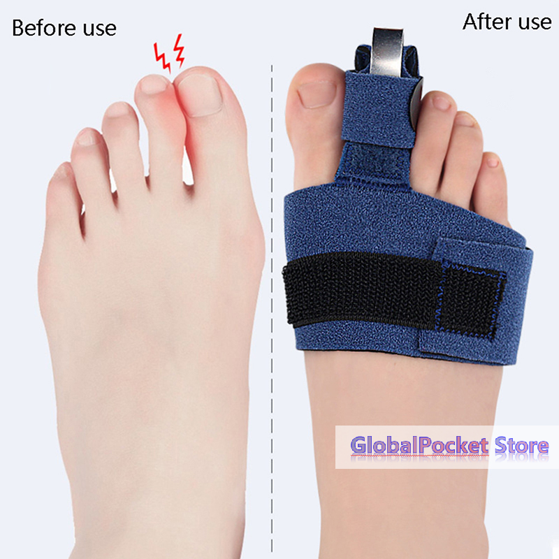 1Pcs Toe Corrector Toe Fractur - Ankle Brace Sock 리뷰 및 가격